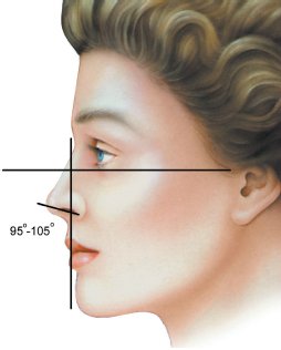 nose-22.jpg nose-22.jpg