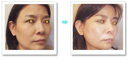 unspecified-9.jpg unspecified-9.jpg