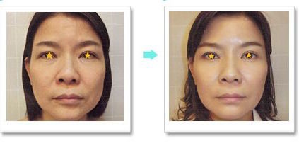 unspecified-8.jpg unspecified-8.jpg