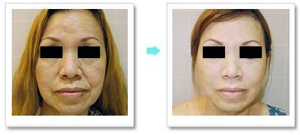 unspecified-6.jpg unspecified-6.jpg