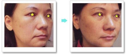 unspecified-2.jpg unspecified-2.jpg