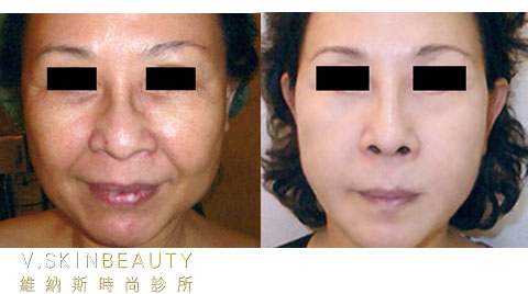 20130817230628-218852.jpg 20130817230628-218852.jpg