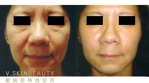 20111114224733-893763.jpg 20111114224733-893763.jpg