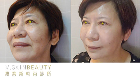 20131031023003-850886.jpg 20131031023003-850886.jpg