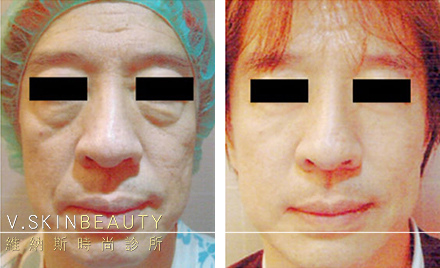 1490941211-2274329451_n.jpg 1490941211-2274329451_n.jpg