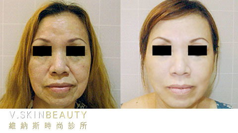 20130920063625-480555.jpg 20130920063625-480555.jpg