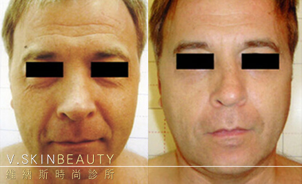 1490941066-2819269923_n.jpg 1490941066-2819269923_n.jpg