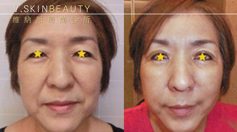 20160106082309-781742.jpg 20160106082309-781742.jpg