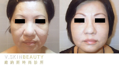 20131223000601-299853.jpg 20131223000601-299853.jpg