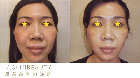 20160106082220-948208.jpg 20160106082220-948208.jpg