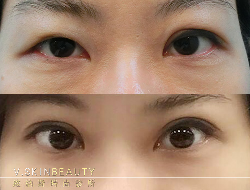 未命名-1.jpg 未命名-1.jpg