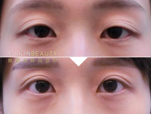 未命名-1.jpg 未命名-1.jpg