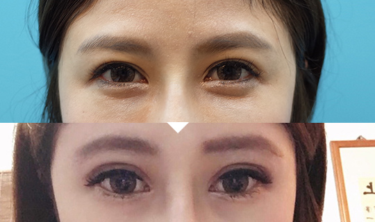 未命名-1.jpg 未命名-1.jpg