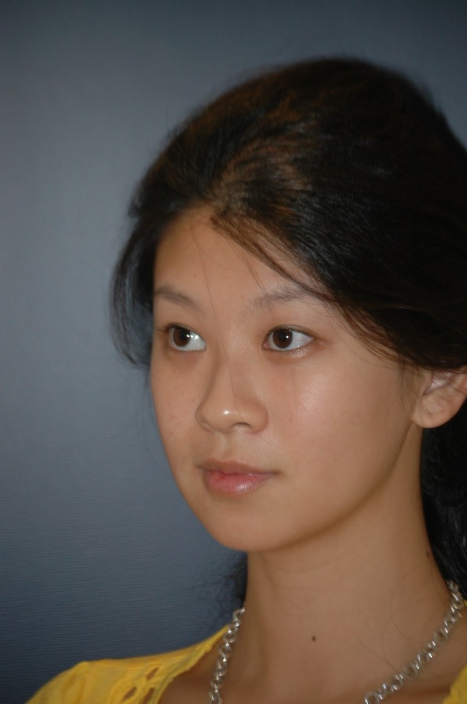 side cheek before.jpg side cheek before.jpg