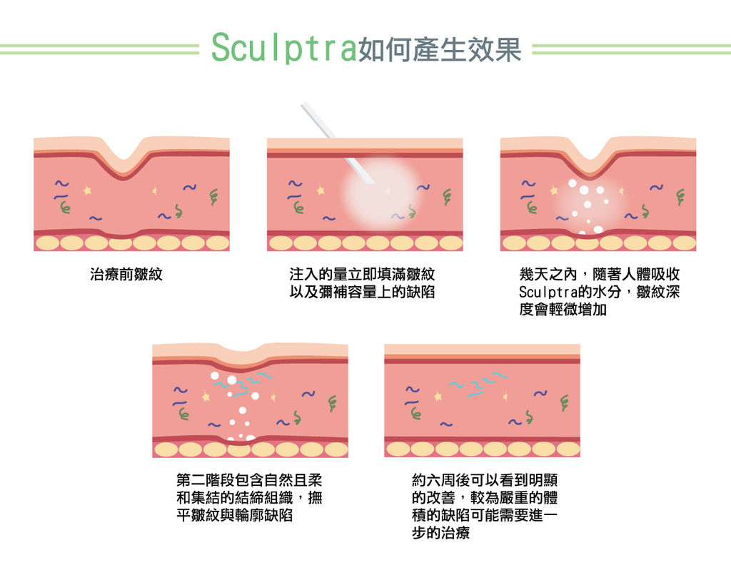 舒顏萃按摩舒顏萃價格舒顏萃失敗舒顏萃副作用舒顏萃ptt舒顏萃淚溝舒顏萃洢蓮絲舒顏萃法令紋舒顏萃一瓶幾cc (6).jpg