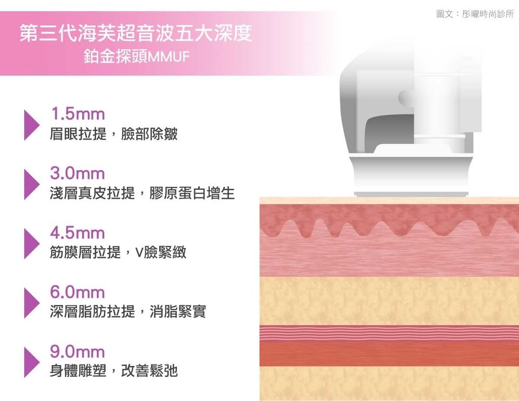 音波拉皮費用音波拉皮推薦音波拉皮多久有效果音波拉皮術後保養音波拉皮會痛嗎音波拉皮效果超音波拉皮價格緊緻小臉臉鬆垮怎麼辦高雄 (4).jpg