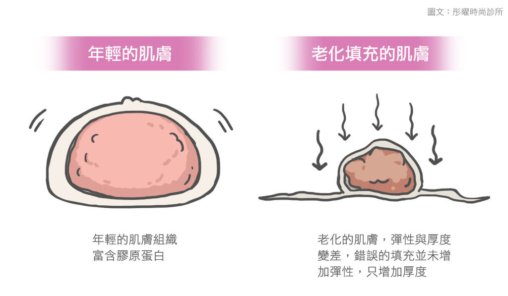 音波拉皮費用音波拉皮推薦音波拉皮多久有效果音波拉皮術後保養音波拉皮會痛嗎音波拉皮效果超音波拉皮價格緊緻小臉臉鬆垮 (2).jpg