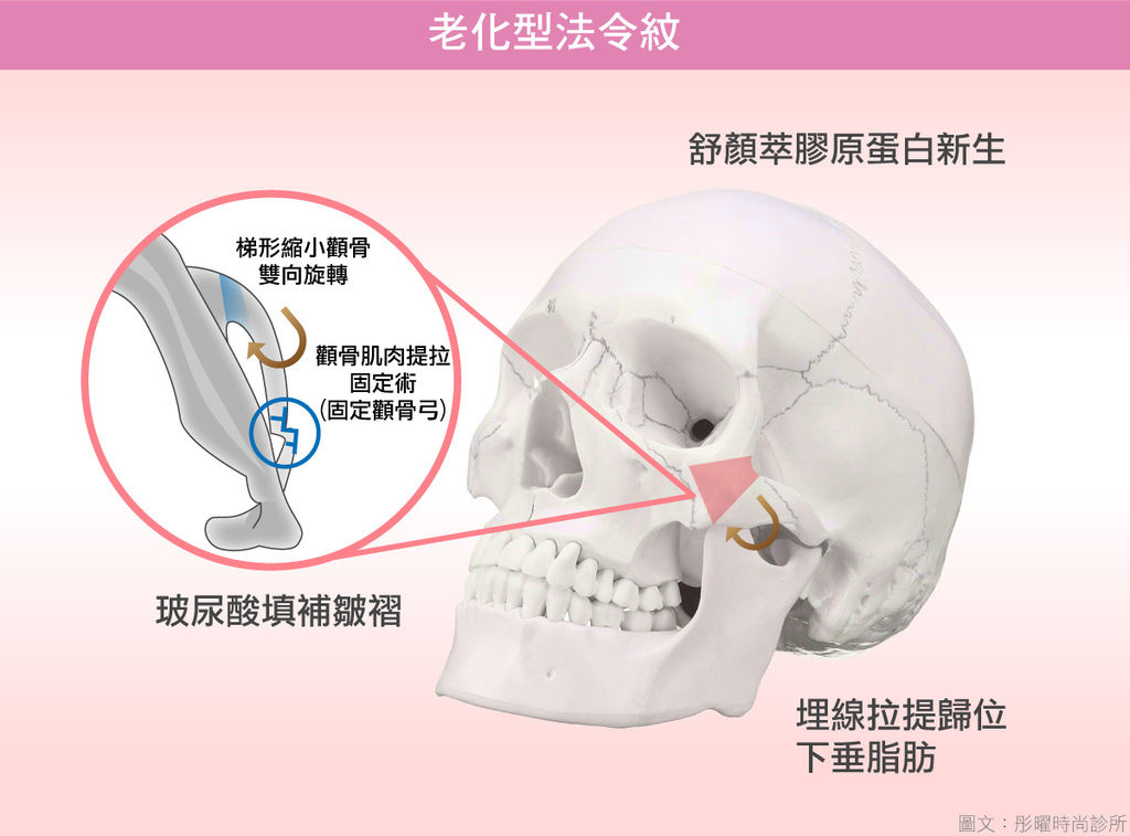 彤耀_法令紋醫美.jpg