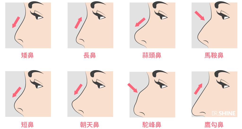 板橋光澤診所結構式隆鼻手術I型鼻膜隆鼻台北醫美整形 (2).jpg 板橋光澤診所結構式隆鼻手術I型鼻膜隆鼻台北醫美整形 (2).jpg