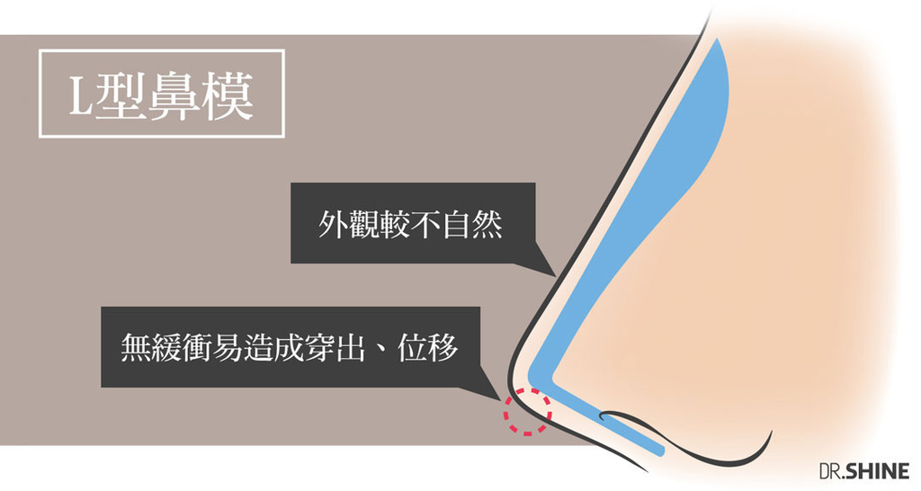 板橋光澤診所結構式隆鼻手術I型鼻膜隆鼻台北醫美整形 (4).jpg 板橋光澤診所結構式隆鼻手術I型鼻膜隆鼻台北醫美整形 (4).jpg