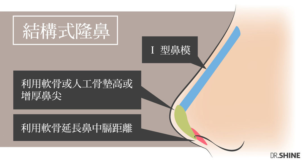 板橋光澤診所結構式隆鼻手術I型鼻膜隆鼻台北醫美整形 (5).jpg 板橋光澤診所結構式隆鼻手術I型鼻膜隆鼻台北醫美整形 (5).jpg