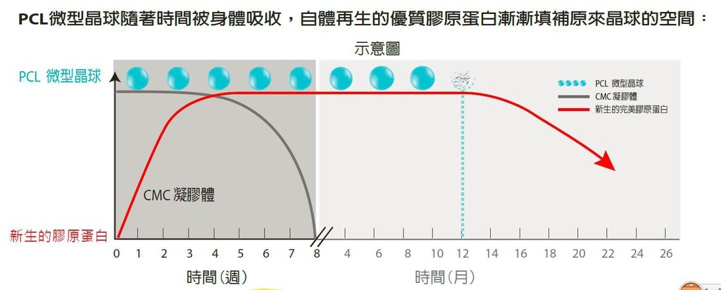 光澤診所Ellanse洢蓮絲膠原蛋白聚己內酯PCL抗老拉提五官雕塑 (3).jpg 光澤診所Ellanse洢蓮絲膠原蛋白聚己內酯PCL抗老拉提五官雕塑 (3).jpg