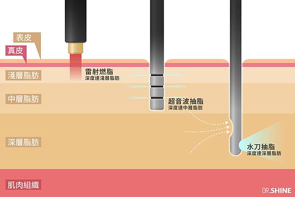 三種治療深度無治療.jpg