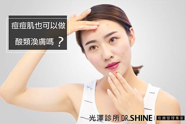 光澤診所美肌杏仁酸 光澤診所美肌杏仁酸