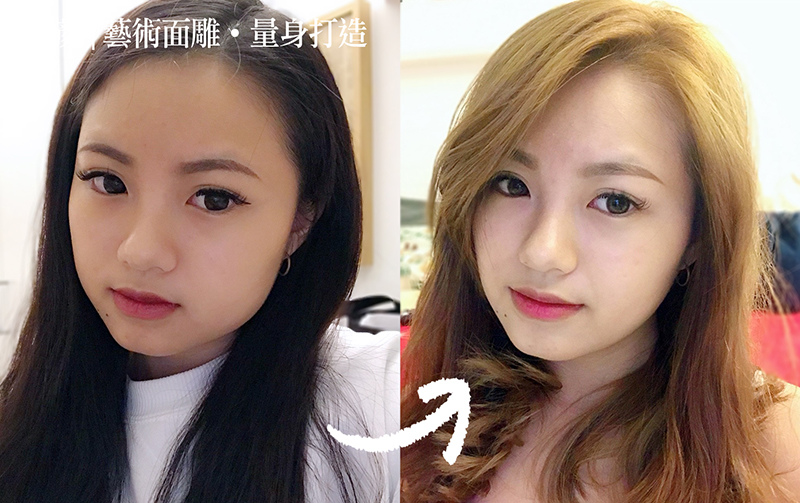 【肉毒桿菌K.O.咀嚼肌】國字臉女孩,一定要知道的精緻小顏技!-洪維志 醫師-瘦小臉-小V臉 【肉毒桿菌K.O.咀嚼肌】國字臉女孩,一定要知道的精緻小顏技!-洪維志 醫師-瘦小臉-小V臉