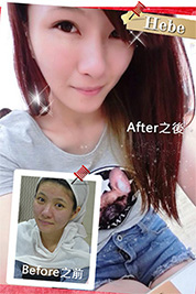 台中朵特菈醫美整形