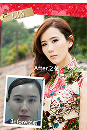 台中朵特菈醫美整形