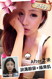 台中朵特菈醫美整形