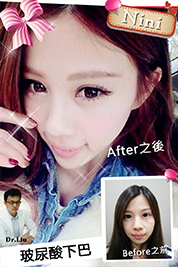 台中朵特菈醫美整形