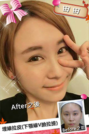 台中朵特菈醫美整形