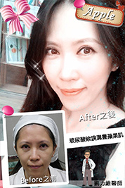 台中朵特菈醫美整形