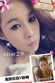 台中朵特菈醫美整形