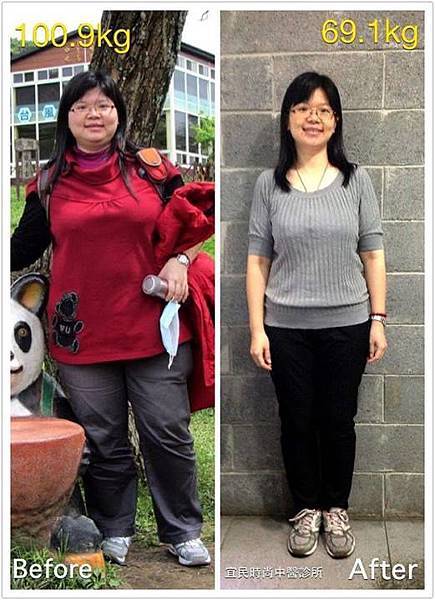 2.jpg 中醫減重,中醫減肥 埋線減重 中醫埋線