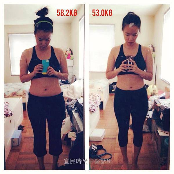 1.jpg 中醫減肥 中醫減重 減肥埋線 台北