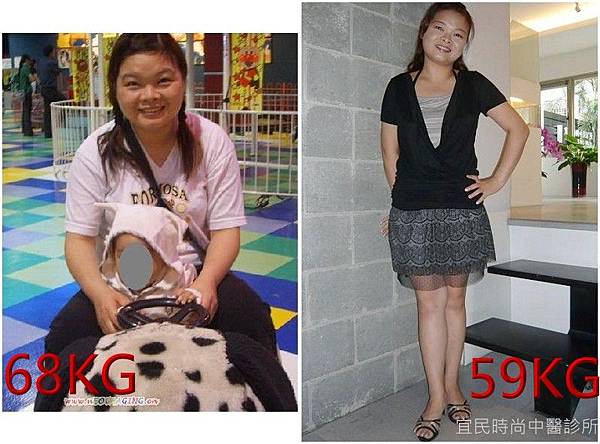 13.jpg 中醫減重台北∣中醫減肥∣中醫減肥門診