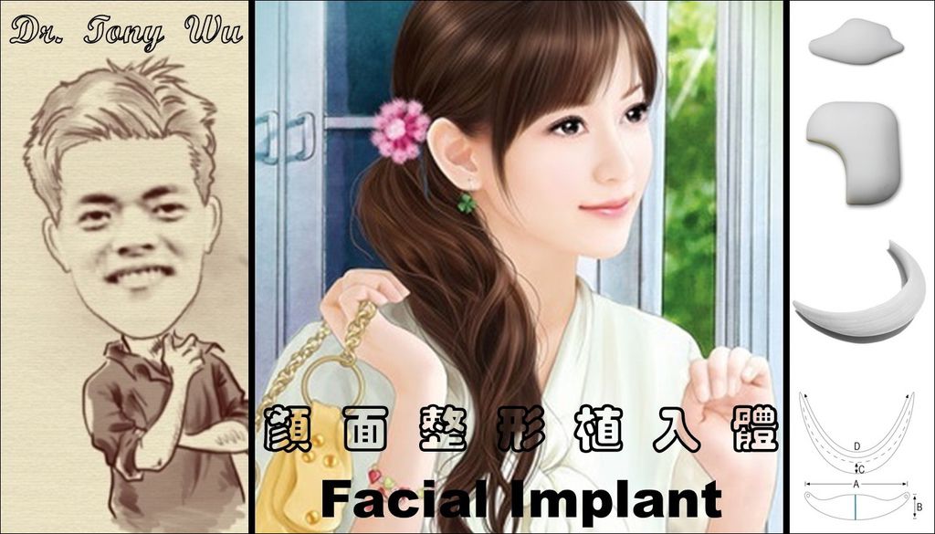 吳教授時間 (人在左側)_05_漫談Facial Implants顏面整形植入體_Black Line