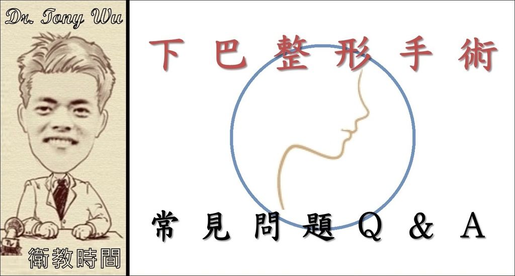 吳教授時間 (人在右側)_05_下巴整形手術-常見問題Q&A v2015-05-25_Black Line 吳教授時間 (人在右側)_05_下巴整形手術-常見問題Q&A v2015-05-25_Black Line