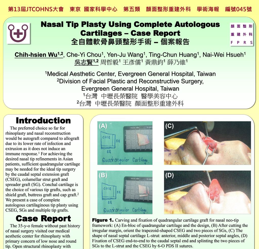 2015.12.03~04 全自體軟骨鼻頭整形手術-個案報告