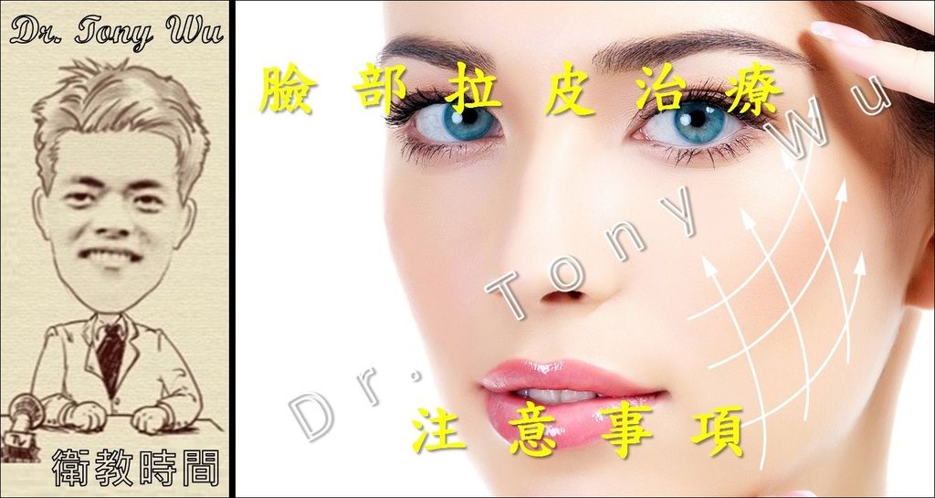 [手術衛教] 臉部拉皮治療 v2017-04-07