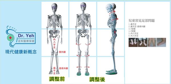 長短腳 人體脊椎圖.jpg 長短腳 人體脊椎圖.jpg