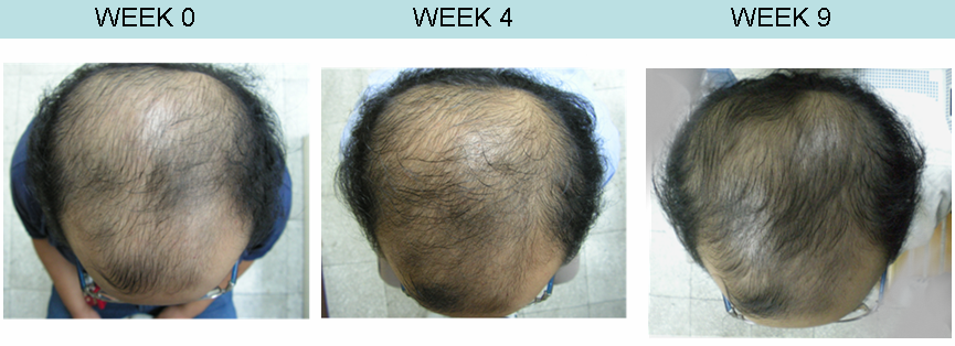 CASE 3 -2 months