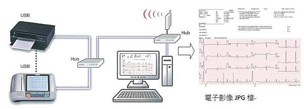 心電圖、十二導程、ECG、EKG、電腦解析判讀、全頁式心電圖、十二導程心電圖、Fukuda、Kenz、PHILIPS、GE-MAC600 心電圖、十二導程、ECG、EKG、電腦解析判讀、全頁式心電圖、十二導程心電圖、Fukuda、Kenz、PHILIPS、GE-MAC600