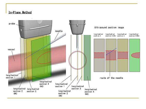 Presentation for T-Shaped probe 2019.06.30_page-0007