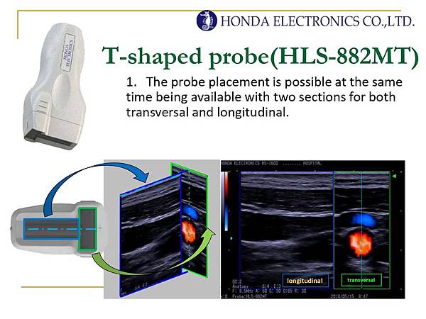 HONDA定位導引Tshaped彩色超音波 日製高階8.4吋 LCD彩色廣角螢幕 雙切面Echo-guided puncture穿刺引導 同時顯示橫/縱切面影像，執行PICC，CVC時正確抓到血管位置避開各神經。 專利T型探頭，配合定位引導器，進行更簡單精確的穿刺。 特別適合心導管檢查，CCU小血管穿刺定位，避免刺穿或失誤。 適合耳鼻喉，聲帶，鼻竇腔掃描及疼痛治療定位注射