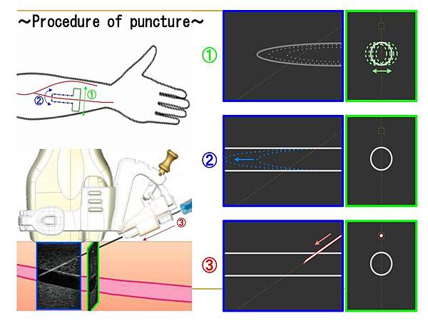 Presentation for T-Shaped probe 2019.06.30_page-0010