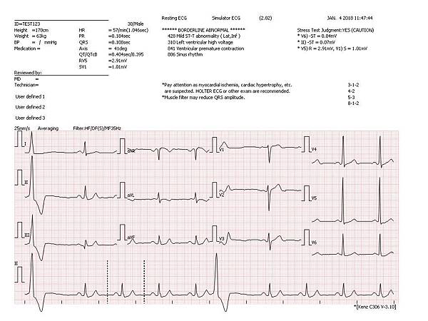 心電圖、十二導程、ECG、EKG、電腦解析判讀、全頁式心電圖、十二導程心電圖、Fukuda、Kenz、PHILIPS、GE-MAC600 心電圖、十二導程、ECG、EKG、電腦解析判讀、全頁式心電圖、十二導程心電圖、Fukuda、Kenz、PHILIPS、GE-MAC600